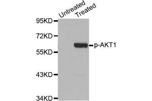 Western Blotting (WB) image for anti-V-Akt Murine Thymoma Viral Oncogene Homolog 1 (AKT1) (pSer473) antibody (ABIN1513328) (AKT1 抗体  (pSer473))