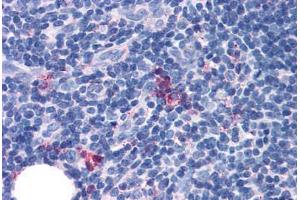 Anti-GPR97 antibody  ABIN1048901 IHC staining of human thymus, medulla. (GPR97 抗体  (Extracellular Domain))