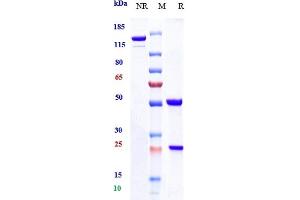 Anti-CXCL10 / IP-10 Reference Antibody (NI-0801) on SDS-PAGE under reducing (R) condition.