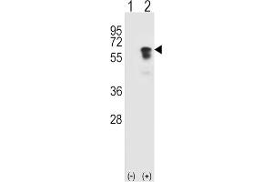 Western Blotting (WB) image for anti-Activin Receptor Type I (ACRV1) antibody (ABIN3003503) (ACVR1 抗体)