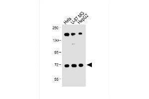 All lanes : Anti-FBXL5 Antibody (N-term) at 1:1000 dilution Lane 1: Hela whole cell lysate Lane 2: U-87 MG whole cell lysate Lane 3: HepG2 whole cell lysate Lysates/proteins at 20 μg per lane. (FBXL5 抗体  (N-Term))