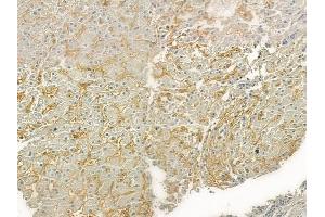 ABIN6261640 and ABIN6276821 at 1/100 staining human normal liver tissue by IHC-P.