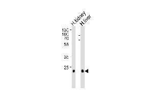 Western blot analysis of lysates from human kidney and liver tissue lysate (from left to right), using CLDN14 Antibody (C-term) (ABIN1881208 and ABIN2838931). (CLDN14 抗体  (C-Term))