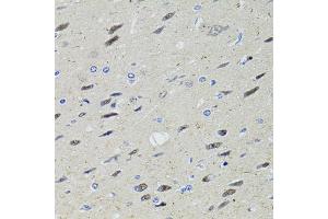 Immunohistochemistry of paraffin-embedded rat brain using STAT1 antibody (ABIN1874962) at dilution of 1:100 (40x lens). (STAT1 抗体)