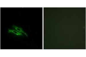 Immunofluorescence analysis of NIH-3T3 cells, using THRB Antibody. (THRB 抗体  (AA 391-440))