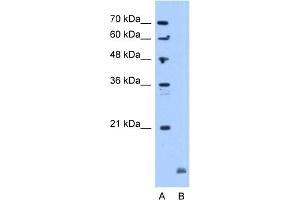 WB Suggested Anti-CRYAB Antibody Titration:  5. (CRYAB 抗体  (C-Term))