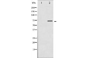 Western blot analysis of p70 S6 Kinase phosphorylation expression in Insulin treated Jurkat whole cell lysates,The lane on the left is treated with the antigen-specific peptide. (RPS6KB1 抗体  (pThr389, pThr412))
