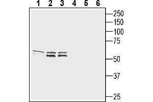 Western blot analysis of rat DRG lysate (lanes 1 and 4), rat brain lysate (lanes 2 and 5), and mouse brain lysate (lanes 3 and 6):1-3.