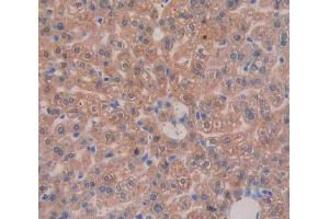 IHC-P analysis of liver tissue, with DAB staining. (Integrin beta 3 抗体  (AA 135-377))