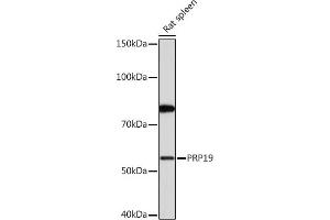 Western blot analysis of extracts of Rat spleen, using PRP19 Rabbit mAb (ABIN7269505) at 1:1000 dilution. (PRP19 抗体)
