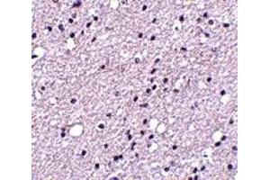 Immunohistochemistry (IHC) image for anti-Tachykinin Receptor 3 (TACR3) (Middle Region) antibody (ABIN1031019) (TACR3 抗体  (Middle Region))