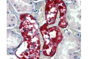 Immunohistochemistry (IHC) image for anti-Glucose 6-Phosphatase, Catalytic (G6PC) (N-Term) antibody (ABIN2781770) (G6PC 抗体  (N-Term))