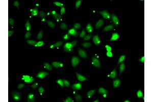 Immunofluorescence analysis of HeLa cells using C1S antibody (ABIN6290127).
