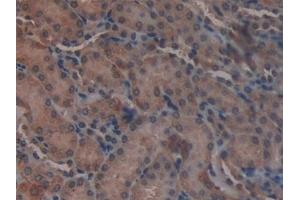 Detection of GLUD1 in Mouse Kidney Tissue using Polyclonal Antibody to Glutamate Dehydrogenase 1 (GLUD1) (GLUD1 抗体  (AA 65-273))