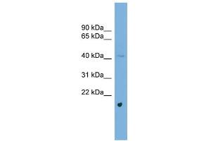 WB Suggested Anti-ABRA Antibody Titration: 0. (ABRA 抗体  (Middle Region))