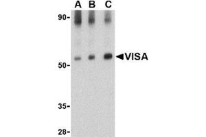 Western blot analysis of VISA in rat brain tissue lysate with this product at (A) 0. (MAVS 抗体  (Middle Region))