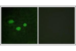 Immunofluorescence analysis of HeLa cells, using DNMT3B Antibody. (DNMT3B 抗体  (N-Term))