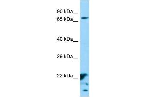 Western Blotting (WB) image for anti-XK, Kell Blood Group Complex Subunit-Related Family, Member 6 (XKR6) (Middle Region) antibody (ABIN2790600) (XKR6 抗体  (Middle Region))