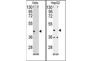 Western blot analysis of anti-hPGK1 pab pre-incubated with and without blocking peptide in Hela (LEFT) and HepG2 (RIGHT) cell line lysate. (PGK1 抗体  (Middle Region))