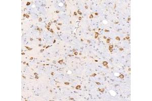 Immunohistochemistry analysis of paraffin-embedded rat brain using,KCNG3 (ABIN7075157) at dilution of 1: 2000 (KCNG3 抗体)