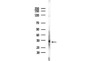 anti-rho Family GTPase 3 (RND3) (Internal Region) antibody