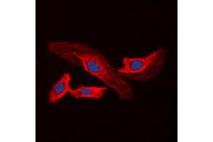 Immunofluorescent analysis of CHSY2 staining in A549 cells. (CHPF 抗体  (C-Term))