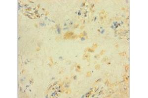 Immunohistochemistry of paraffin-embedded human placenta tissue using ABIN7154468 at dilution of 1:100 (GADD45B 抗体  (AA 1-160))