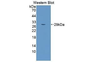 Western Blotting (WB) image for anti-Sema Domain, Seven Thrombospondin Repeats (Type 1 and Type 1-Like), Transmembrane Domain (TM) and Short Cytoplasmic Domain, (Semaphorin) 5B (SEMA5B) (AA 350-602) antibody (ABIN5662014) (SEMA5B 抗体  (AA 350-602))