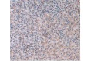 Detection of a1AGP in Rat Adrenal Gland Tissue using Monoclonal Antibody to Alpha-1-Acid Glycoprotein (a1AGP) (ORM1 抗体  (AA 19-186))
