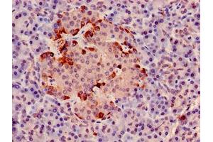 Immunohistochemistry (IHC) image for anti-Cytochrome C1 (CYC1) (AA 85-325) antibody (ABIN7149190)