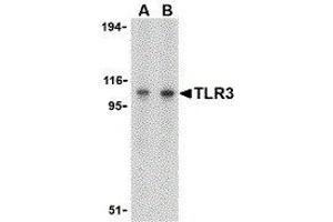 Western Blotting (WB) image for anti-Toll-Like Receptor 3 (TLR3) (C-Term) antibody (ABIN2479740) (TLR3 抗体  (C-Term))
