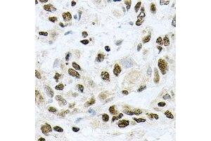 Immunohistochemical analysis of UBE2B staining in rat lung formalin fixed paraffin embedded tissue section. (UBE2B 抗体)