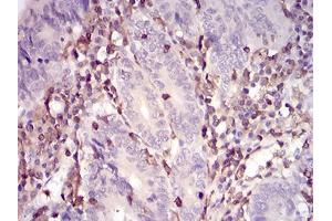 Immunohistochemistry (IHC) image for anti-Wiskott-Aldrich Syndrome (Eczema-thrombocytopenia) (WAS) (AA 57-170) antibody (ABIN5542679)
