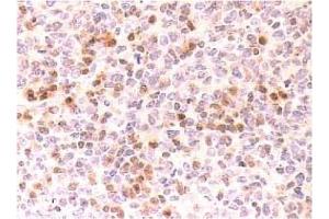 Immunohistochemistry (IHC) image for anti-Cyclin-Dependent Kinase Inhibitor 2C (p18, Inhibits CDK4) (CDKN2C) antibody (ABIN487307) (CDKN2C 抗体)