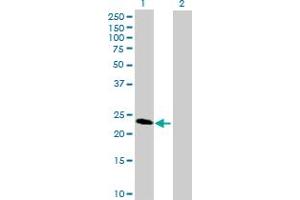 Western Blot analysis of SECTM1 expression in transfected 293T cell line by SECTM1 MaxPab polyclonal antibody. (SECTM1 抗体  (AA 29-248))