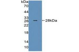 Detection of Recombinant MED1, Human using Polyclonal Antibody to Mediator Complex Subunit 1 (MED1) (MED1 抗体  (AA 1-212))