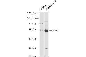 Western blot analysis of extracts of various cell lines, using DOK2 antibody (ABIN6130308, ABIN6139765, ABIN6139767 and ABIN6218320) at 1:1000 dilution. (DOK2 抗体  (AA 1-260))