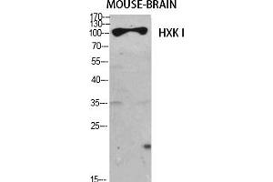 Western Blot analysis of various cells using HXK I Polyclonal Antibody diluted at 1:1000. (HXK I (AA 1-80) 抗体)