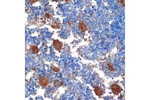 Immunohistochemistry of paraffin-embedded mouse bone marrow using CXCL4/CXCL4/PF4 Rabbit mAb (ABIN1683188, ABIN3017983, ABIN3017984 and ABIN7101555) at dilution of 1:100 (40x lens). (PF4 抗体)