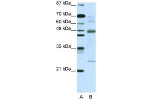 WB Suggested Anti-NFKBIB  Antibody Titration: 5. (NFKBIB 抗体  (C-Term))