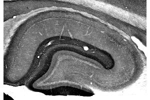 Adult rat hippocampus immunohistochemistry. (ADAM22 抗体  (Cytosolic))