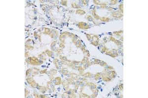 Immunohistochemistry of paraffin-embedded human stomach using ATPIF1 antibody. (ATPase Inhibitory Factor 1 抗体  (AA 26-106))