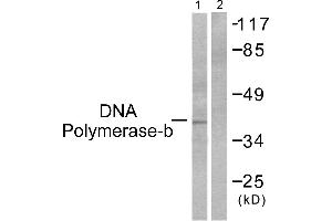 Western blot analysis of extracts from NIH/3T3 cells, using DNA Polymerase β antibody (#C0173).