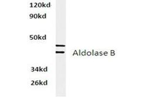 Image no. 2 for anti-Aldolase B, Fructose-Bisphosphate (ALDOB) antibody (ABIN317837) (ALDOB 抗体)