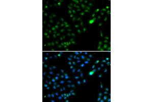 Immunofluorescence analysis of HeLa cell using FKBP3 antibody. (FKBP3 抗体)