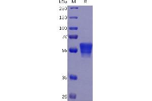 SDS-PAGE (SDS) image for CD7 (CD7) (AA 26-180) protein (mFc Tag) (ABIN6961151)