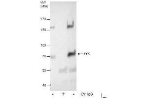 IP Image Immunoprecipitation of SYK protein from A431 whole cell extracts using 5 μg of SYK antibody [N2C2], Western blot analysis was performed using SYK antibody [N2C2], EasyBlot anti-Rabbit IgG  was used as a secondary reagent. (SYK 抗体  (Internal Region))