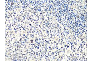 Immunohistochemistry of paraffin-embedded human tonsil using MTA2 Antibody (ABIN5998268) at dilution of 1/100 (40x lens). (MTA2 抗体)