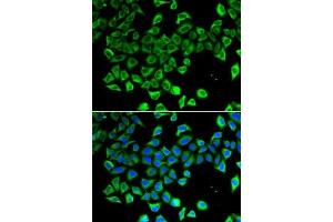 Immunofluorescence analysis of A-549 cells using Lipocalin-2/NGAL antibody (ABIN6128177, ABIN6143114, ABIN6143115 and ABIN6215076). (Lipocalin 2 抗体)