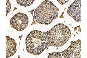 ABIN7095739 and ABIN7099801 at 1/100 staining mouse testis tissue by IHC-P. (MGAT5 抗体)